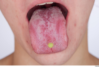 Rada piercing tongue 0001.jpg